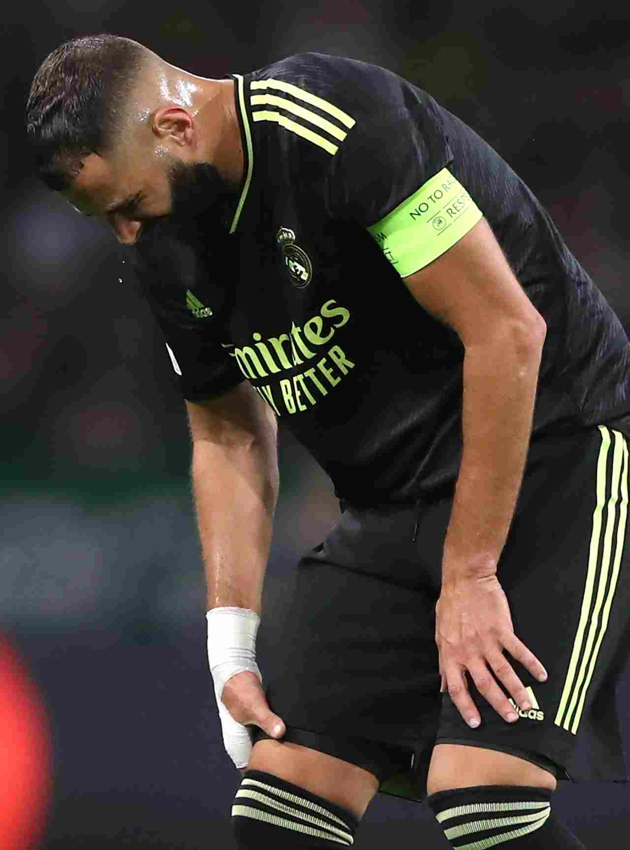 Infortunio Benzema, Real Madrid - stopandgoal.com (La Presse)
