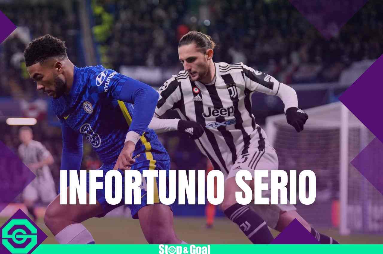 Infortunio Nazionale, salta il Mondiale - stopandgoal.com (La Presse)